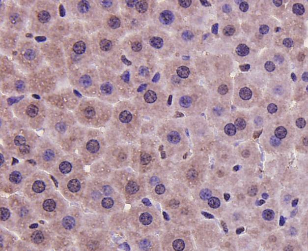 Immunohistochemical analysis of paraffin-embedded mouse liver tissue using anti-PRMT5 antibody. Counter stained with hematoxylin.