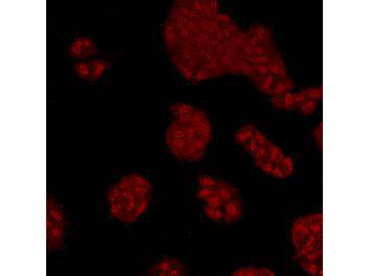 ICC staining of MAPK14 in Hela cells (red). Cells were fixed in paraformaldehyde, permeabilised with 0.25% Triton X100/PBS.
