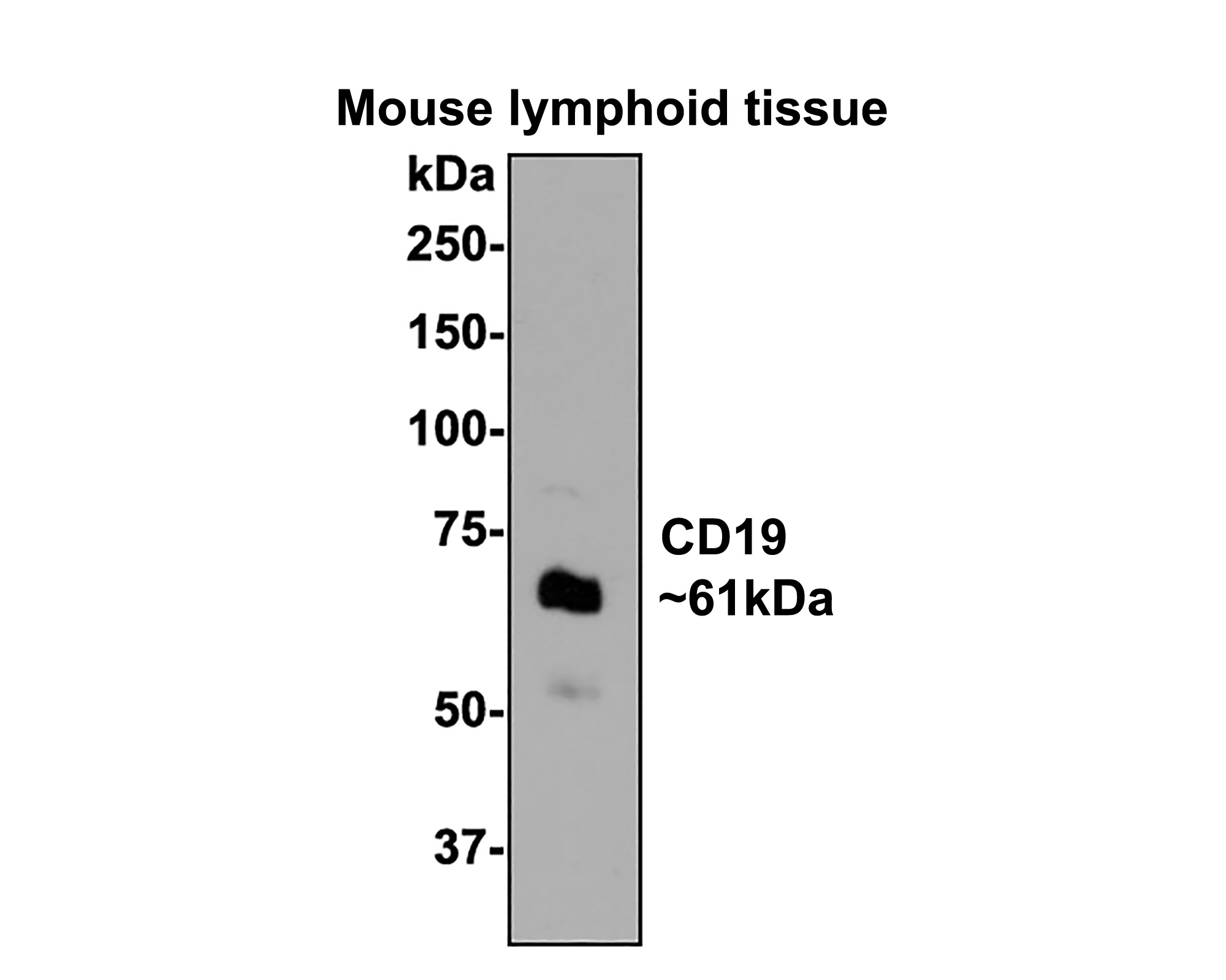 Western blot analysis of CD19 on mouse lymphoid lysates with Mouse anti-CD19 antibody (EM40308) at 1/500 dilution.<br />
<br />
Lysates/proteins at 20 µg/Lane.<br />
<br />
Predicted band size: 61 kDa<br />
Observed band size: 61 kDa<br />
<br />
Exposure time: 1 minute;<br />
<br />
8% SDS-PAGE gel.<br />
<br />
Proteins were transferred to a PVDF membrane and blocked with 5% NFDM/TBST for 1 hour at room temperature. The primary antibody (EM40308) at 1/500 dilution was used in 5% NFDM/TBST at room temperature for 2 hours. Goat Anti-Mouse IgG - HRP Secondary Antibody (HA1006) at 1:100,000 dilution was used for 1 hour at room temperature.