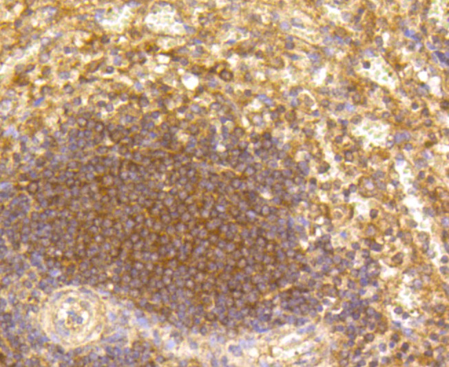 Immunohistochemical analysis of paraffin-embedded human spleen tissue using anti-CD19 antibody. The section was pre-treated using heat mediated antigen retrieval with Tris-EDTA buffer (pH 8.0-8.4) for 20 minutes.The tissues were blocked in 5% BSA for 30 minutes at room temperature, washed with ddH2O and PBS, and then probed with the primary antibody (EM40308, 1/50) for 30 minutes at room temperature. The detection was performed using an HRP conjugated compact polymer system. DAB was used as the chromogen. Tissues were counterstained with hematoxylin and mounted with DPX.
