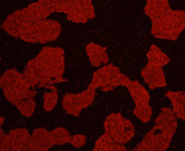 ICC staining Akt1 in Hela cells (red). Cells were fixed in paraformaldehyde, permeabilised with 0.25% Triton X100/PBS.
