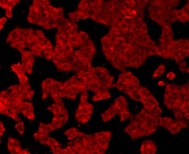 ICC staining GPX1 in Hela cells (red). Cells were fixed in paraformaldehyde, permeabilised with 0.25% Triton X100/PBS.