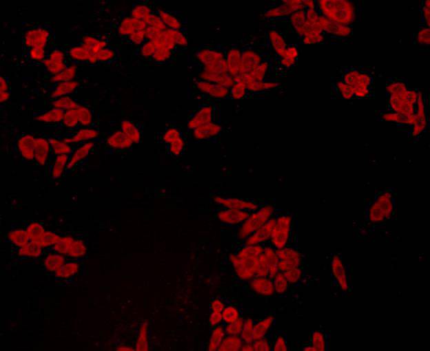 ICC staining GPX1 in HepG2 cells (red). Cells were fixed in paraformaldehyde, permeabilised with 0.25% Triton X100/PBS.
