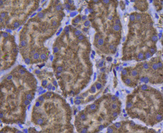 Immunohistochemical analysis of paraffin-embedded human kidney tissue using anti-GPX1 antibody. Counter stained with hematoxylin.