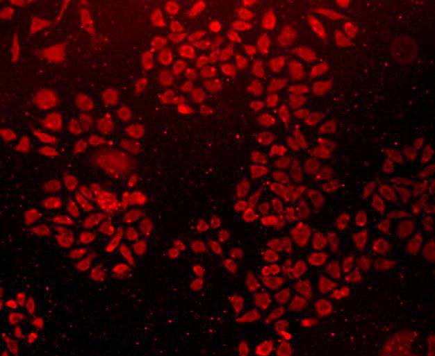ICC staining Caveolin-1 in L929 cells (red). Cells were fixed in paraformaldehyde, permeabilised with 0.25% Triton X100/PBS.