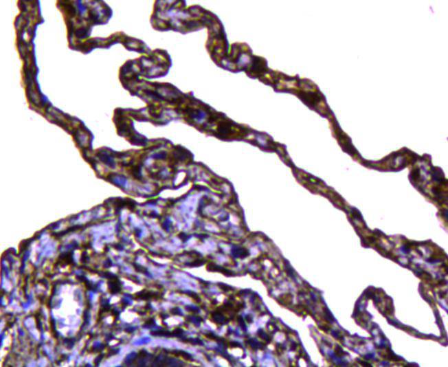 Immunohistochemical analysis of paraffin-embedded human lung tissue using anti-Caveolin-1 antibody. Counter stained with hematoxylin.