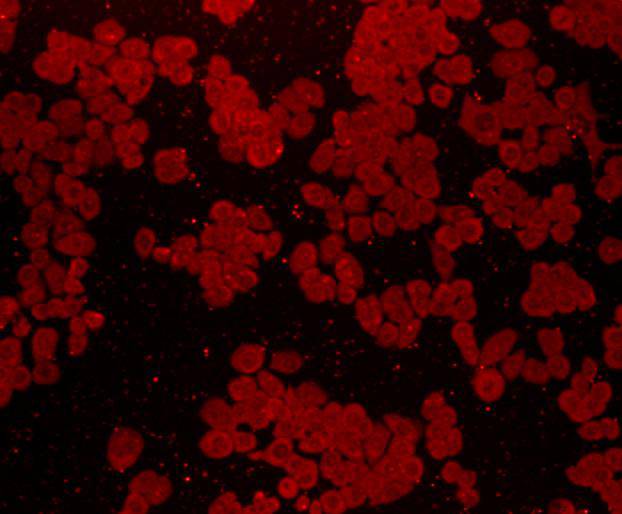 ICC staining of FGFR2 in Ags cells (red). Cells were fixed in paraformaldehyde, permeabilised with 0.25% Triton X100/PBS.