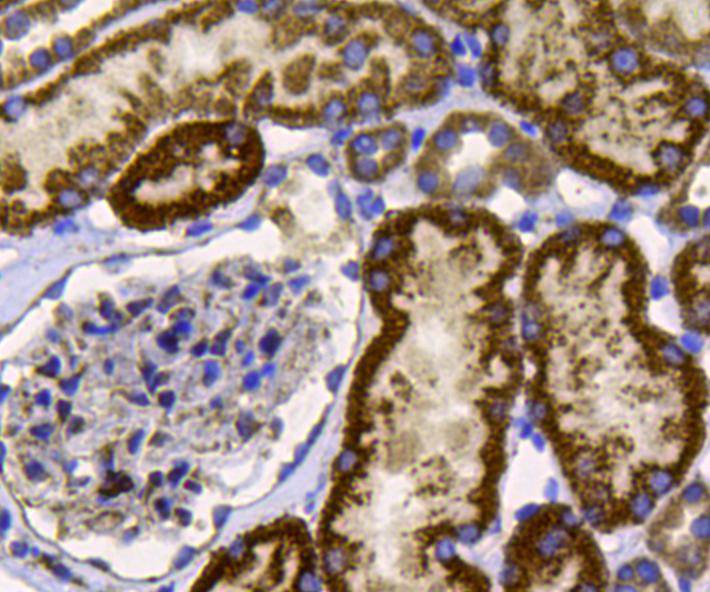 Immunohistochemical analysis of paraffin-embedded human kidney tissue using anti-FGFR2 antibody. Counter stained with hematoxylin.