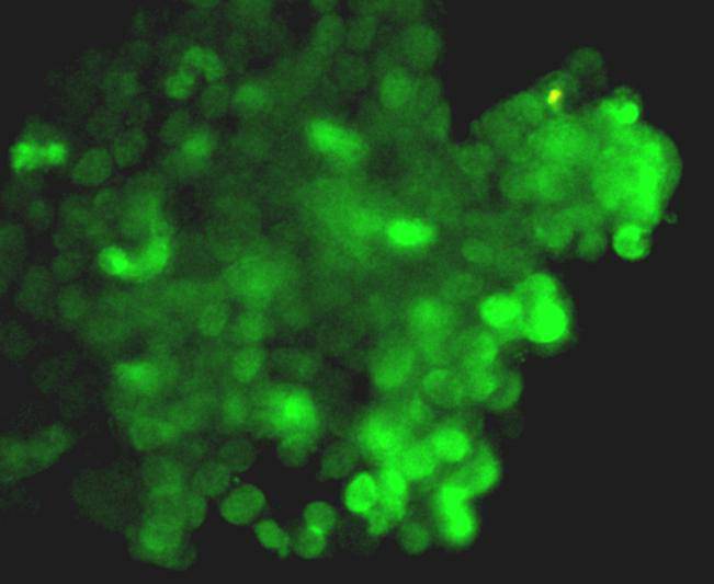 Immunofluorescence staining CRISPR-Cas9 in CRISPR-Cas9 transfected 293T cells (green). Cells were fixed in paraformaldehyde, permeabilised with 0.25% Triton X100/PBS.