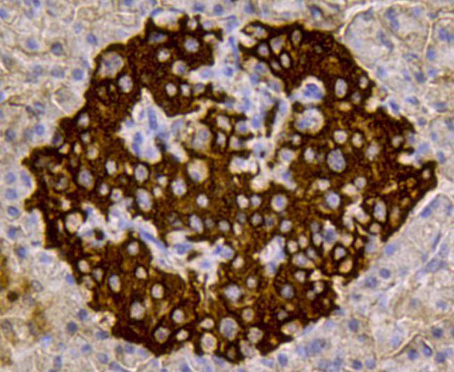 Immunohistochemical analysis of paraffin-embedded human pancreas tissue using anti-Insulin antibody. Counter stained with hematoxylin.