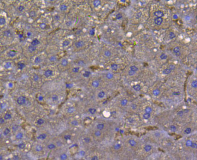 Immunohistochemical analysis of paraffin-embedded human liver tissue using anti-LDHA antibody. The section was pre-treated using heat mediated antigen retrieval with Tris-EDTA buffer (pH 9.0) for 20 minutes.The tissues were blocked in 1% BSA for 30 minutes at room temperature, washed with ddH2O and PBS, and then probed with the primary antibody (ER00702, 1/50) for 30 minutes at room temperature. The detection was performed using an HRP conjugated compact polymer system. DAB was used as the chromogen. Tissues were counterstained with hematoxylin and mounted with DPX.