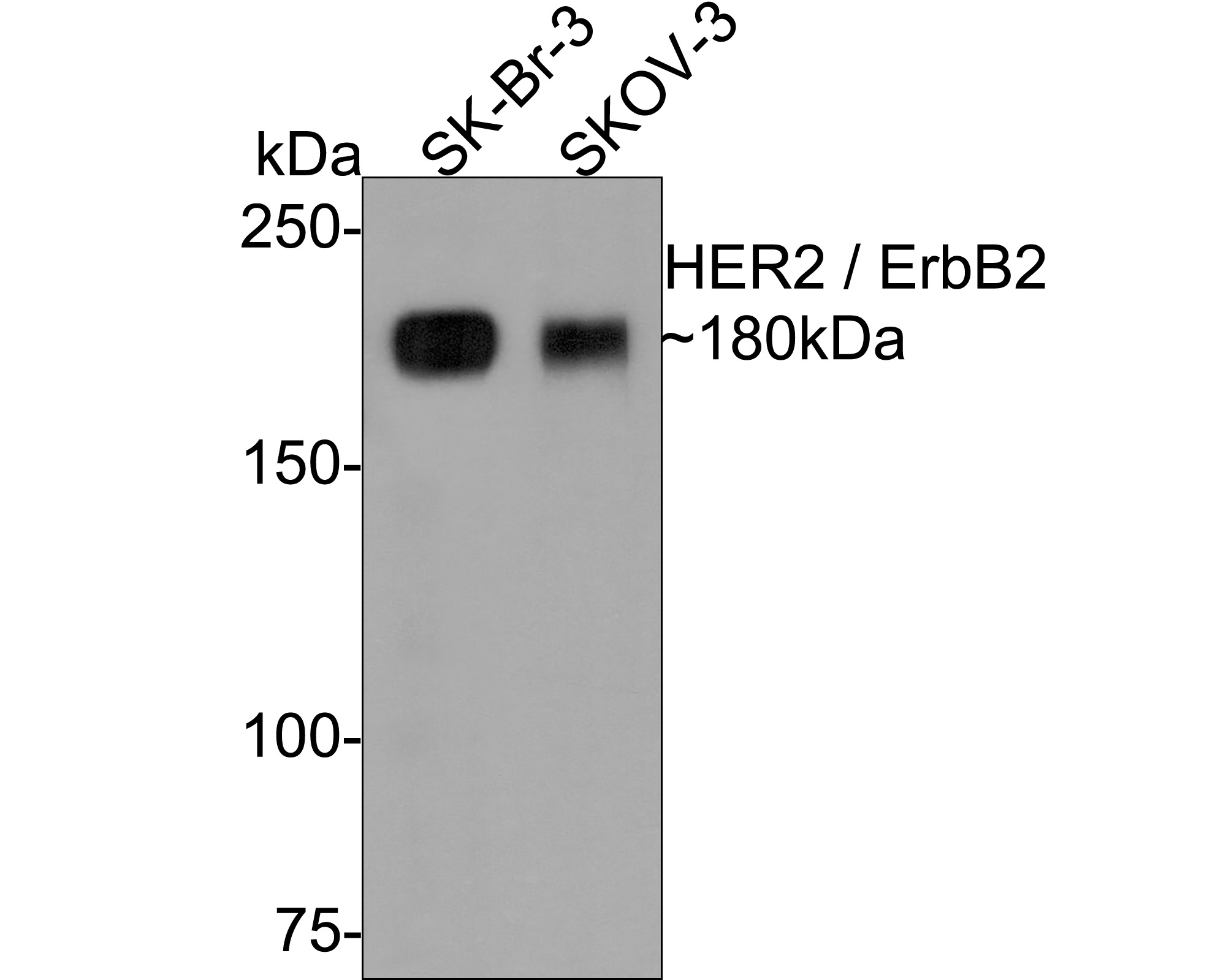 Western blot analysis of HER2 / ErbB2 on different lysates with Rabbit anti-HER2 / ErbB2 antibody (ER0106) at 1/1,000 dilution.<br />
<br />
Lane 1: SK-Br-3 cell lysate<br />
Lane 2: SKOV-3 cell lysate<br />
<br />
Lysates/proteins at 10 µg/Lane.<br />
<br />
Predicted band size: 138 kDa<br />
Observed band size: 180 kDa<br />
<br />
Exposure time: 2 minutes;<br />
<br />
6% SDS-PAGE gel.<br />
<br />
Proteins were transferred to a PVDF membrane and blocked with 5% NFDM/TBST for 1 hour at room temperature. The primary antibody (ER0106) at 1/1,000 dilution was used in 5% NFDM/TBST at room temperature for 2 hours. Goat Anti-Rabbit IgG - HRP Secondary Antibody (HA1001) at 1:300,000 dilution was used for 1 hour at room temperature.
