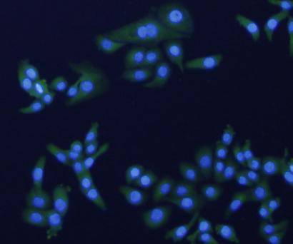 ICC staining of HER2 / ErbB2 in SKOV-3 cells (green). Formalin fixed cells were permeabilized with 0.1% Triton X-100 in TBS for 10 minutes at room temperature and blocked with 1% Blocker BSA for 15 minutes at room temperature. Cells were probed with the primary antibody (ER0106, 1/50) for 1 hour at room temperature, washed with PBS. Alexa Fluor®488 Goat anti-Rabbit IgG was used as the secondary antibody at 1/1,000 dilution. The nuclear counter stain is DAPI (blue).