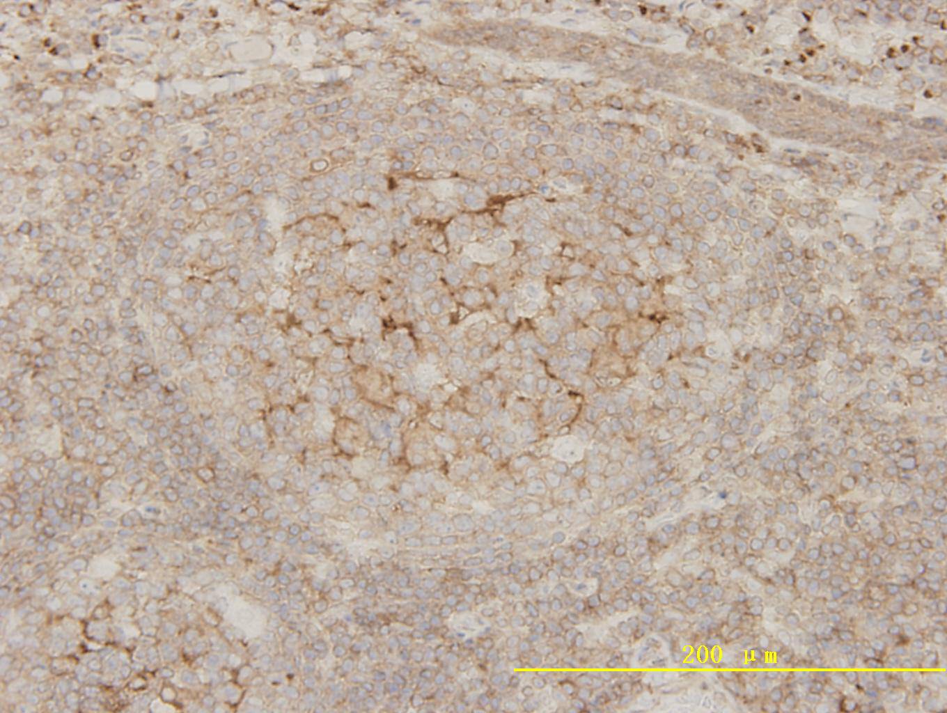 Immunohistochemical analysis of paraffin-embedded human tonsil tissue using anti-Bcl-2 rabbit polyclonal antibody. Counter stained with hematoxylin.