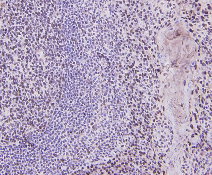 Immunohistochemical analysis of paraffin-embedded human tonsil tissue using anti-Cyclin D1 antibody. Counter stained with hematoxylin.