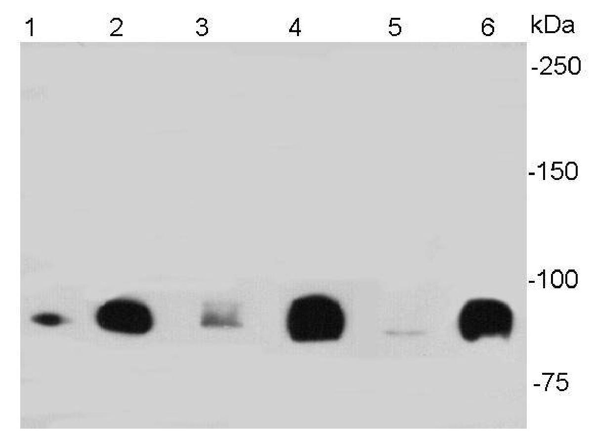 Western blot analysis of beta Catenin on different lysates. Proteins were transferred to a PVDF membrane and blocked with 5% NFDM/TBST for 1 hour at room temperature. The primary antibody (ER0805, 1/1,000) was used in 5% NFDM/TBST at room temperature for 1 hour. Goat Anti-Rabbit IgG - HRP Secondary Antibody (HA1001) at 1:200,000 dilution was used for 45 mins at room temperature.<br />
Positive control:<br />
Lane 1: A431 cell lysates<br />
Lane 2: SW480 cell lysates<br />
Lane 3: HCT116 cell lysates<br />
Lane 4: HT-29 cell lysates<br />
Lane 5: Mouse colon tissue lysates<br />
Lane 6: Mouse brain tissue lysates