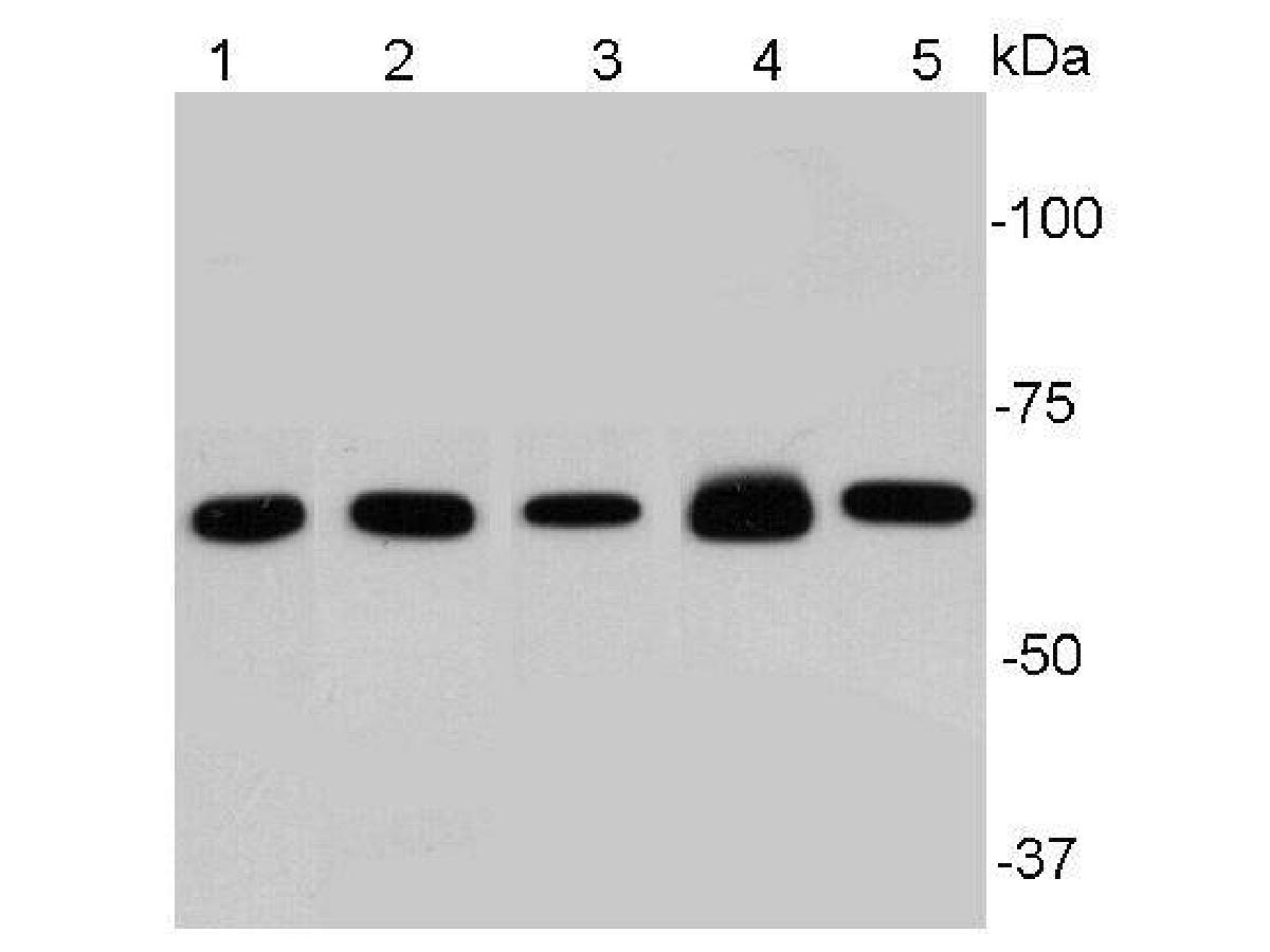 Western blots show p65 antibodies that passed the test of specificity