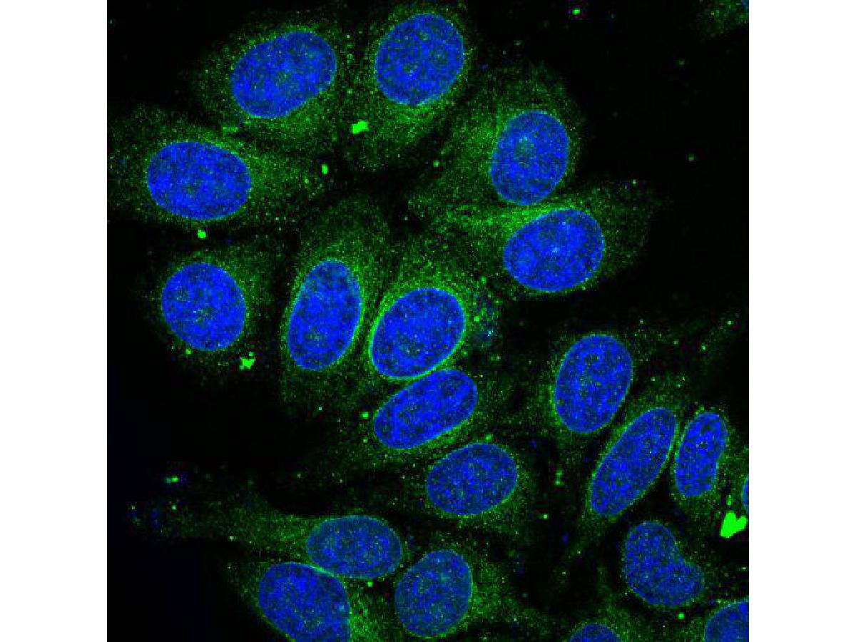 ICC staining Bax in F9 cells (green). The nuclear counter stain is DAPI (blue). Cells were fixed in paraformaldehyde, permeabilised with 0.25% Triton X100/PBS.