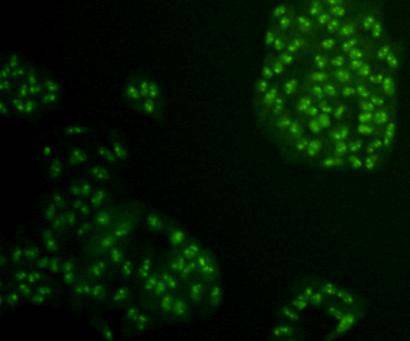 ICC staining HMGB1 in Hela cells (green). Cells were fixed in paraformaldehyde, permeabilised with 0.25% Triton X100/PBS.