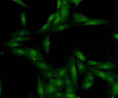 ICC staining HMGB1 in NIH/3T3 cells (green). Cells were fixed in paraformaldehyde, permeabilised with 0.25% Triton X100/PBS.