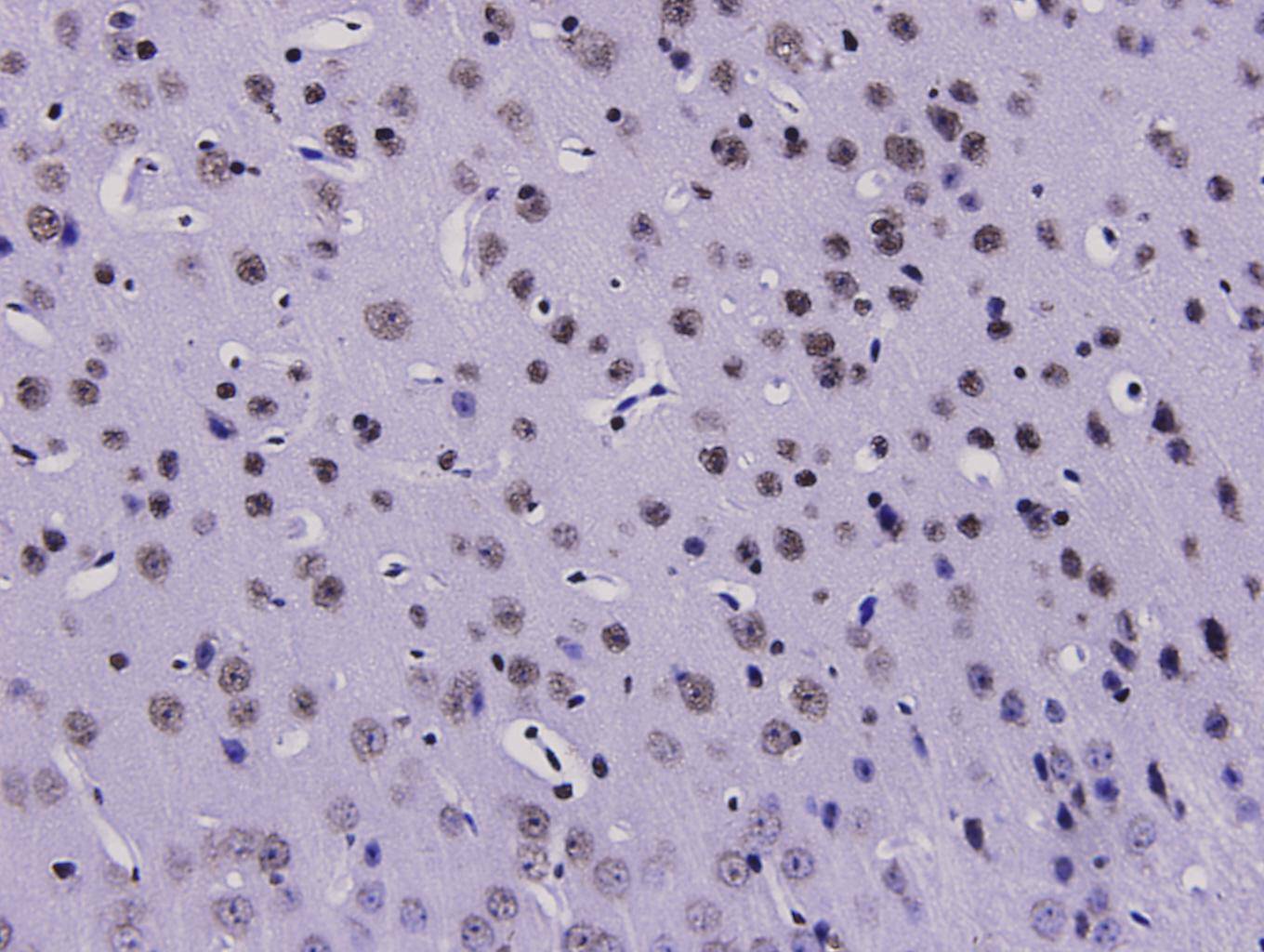 Immunohistochemical analysis of paraffin-embedded mouse brain tissue using anti- HMGB1 antibody. Counter stained with hematoxylin.