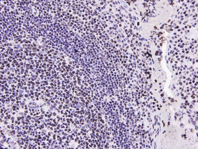 Immunohistochemical analysis of paraffin-embedded human tonsil tissue using anti- HMGB1 antibody. Counter stained with hematoxylin.