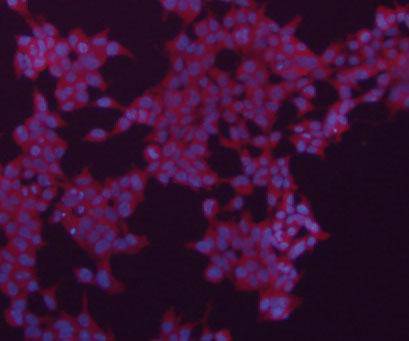 ICC staining of Alpha smooth muscle actin in 293 cells (red). The nuclear counter stain is DAPI (blue). Cells were fixed in paraformaldehyde, permeabilised with 0.25% Triton X100/PBS.