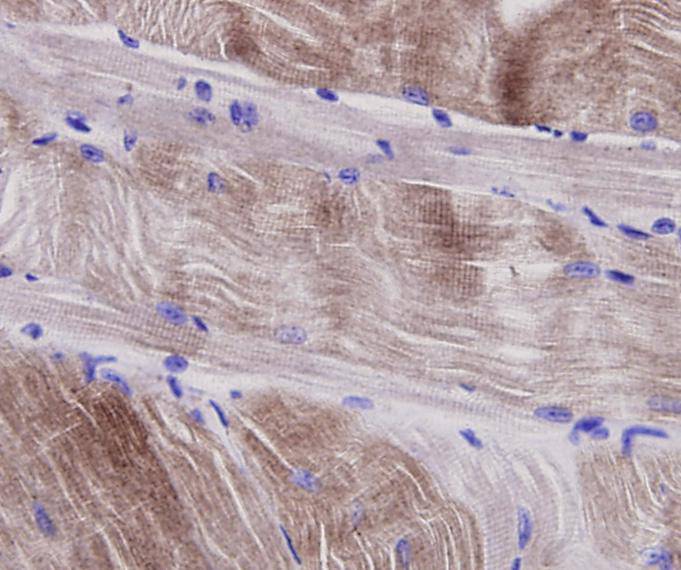 Immunohistochemical analysis of paraffin-embedded mouse smooth muscle tissue using anti-Alpha smooth muscle actin antibody. Counter stained with hematoxylin.