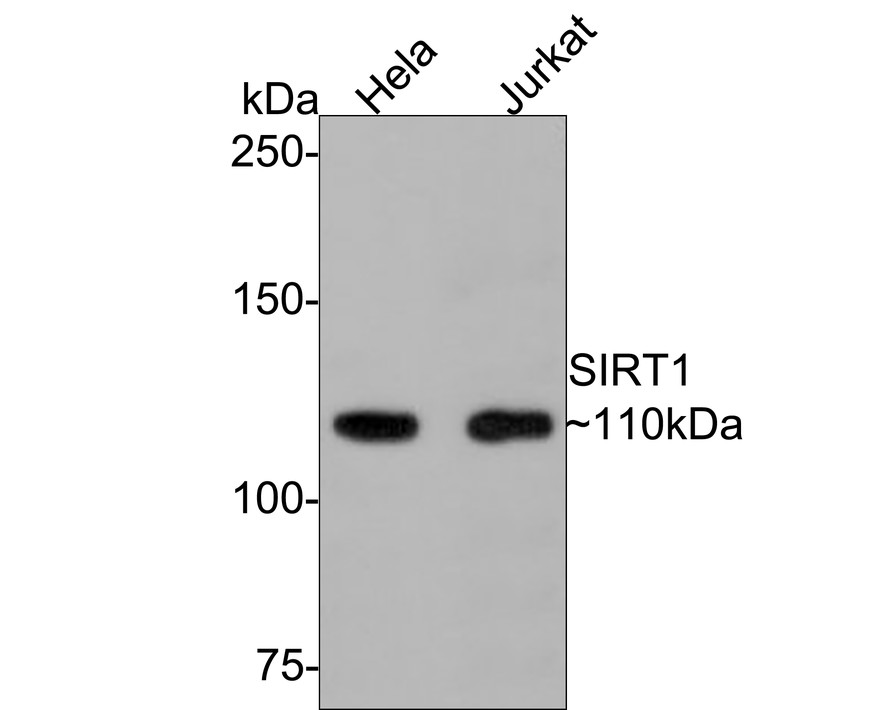 Western blot analysis of SIRT1 on different lysates with Rabbit anti-SIRT1 antibody (ER130811) at 1/500 dilution.<br />
<br />
Lane 1: Hela cell lysate<br />
Lane 2: Jurkat cell lysate<br />
<br />
Lysates/proteins at 10 µg/Lane.<br />
<br />
Predicted band size: 82 kDa<br />
Observed band size: 110 kDa<br />
<br />
Exposure time: 2 minutes;<br />
<br />
6% SDS-PAGE gel.<br />
<br />
Proteins were transferred to a PVDF membrane and blocked with 5% NFDM/TBST for 1 hour at room temperature. The primary antibody (ER130811) at 1/500 dilution was used in 5% NFDM/TBST at room temperature for 2 hours. Goat Anti-Rabbit IgG - HRP Secondary Antibody (HA1001) at 1:300,000 dilution was used for 1 hour at room temperature.