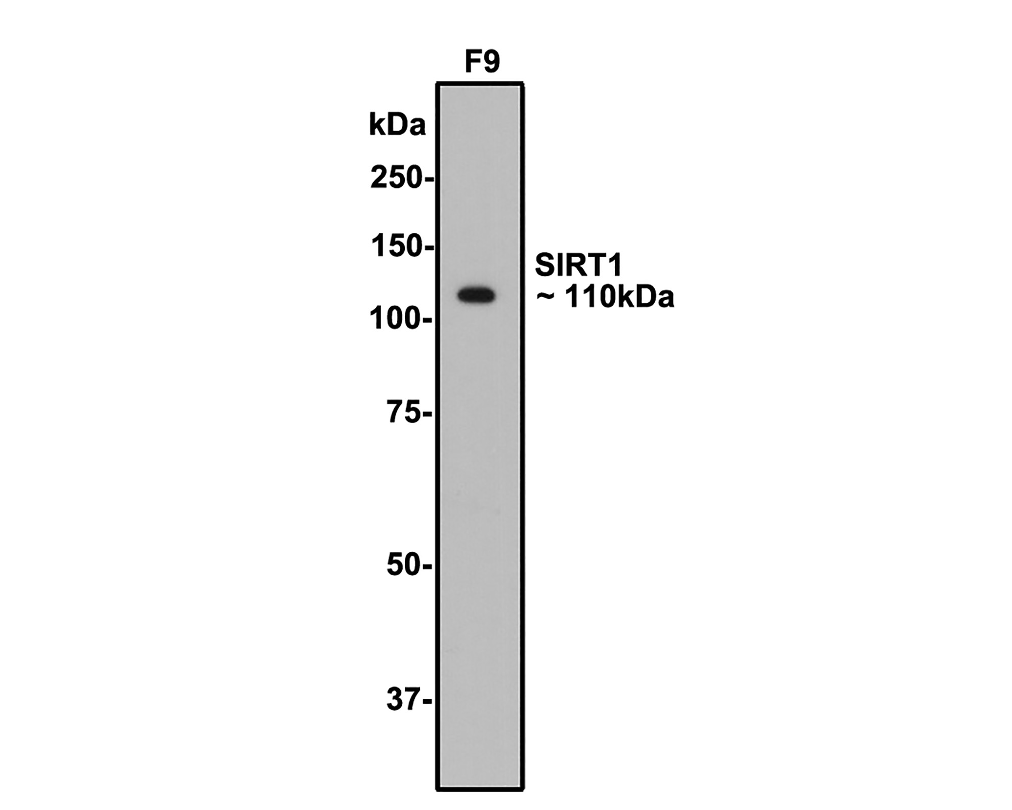 Western blot analysis of SIRT1 on F9 cell lysates with Rabbit anti-SIRT1 antibody (ER130811) at 1/2,000 dilution.<br />
<br />
Lysates/proteins at 10 µg/Lane.<br />
<br />
Predicted band size: 82 kDa<br />
Observed band size: 110 kDa<br />
<br />
Exposure time: 1 minute;<br />
<br />
8% SDS-PAGE gel.<br />
<br />
Proteins were transferred to a PVDF membrane and blocked with 5% NFDM/TBST for 1 hour at room temperature. The primary antibody (ER130811) at 1/2,000 dilution was used in 5% NFDM/TBST at room temperature for 2 hours. Goat Anti-Rabbit IgG - HRP Secondary Antibody (HA1001) at 1:300,000 dilution was used for 1 hour at room temperature.