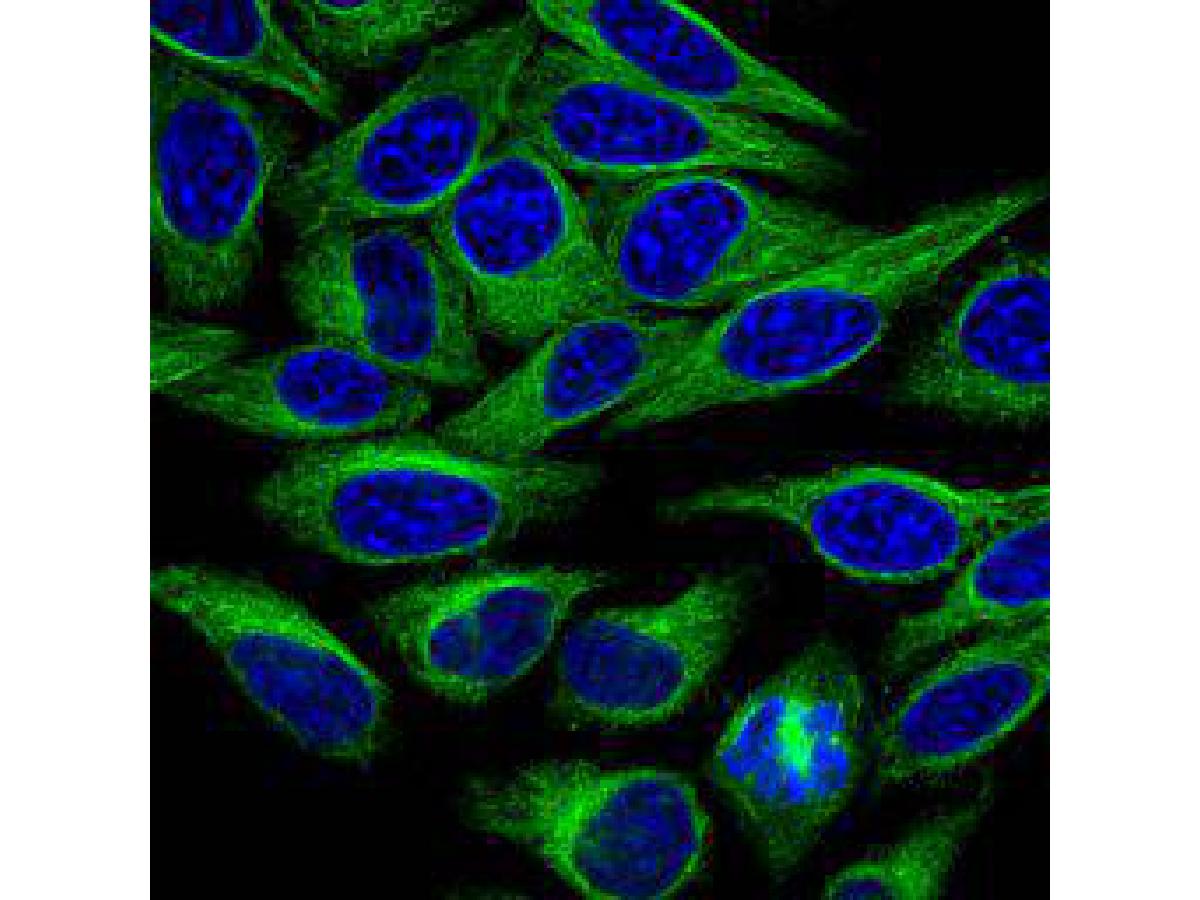 ICC staining of Alpha-tubulin in Hela cells (green). Formalin fixed cells were permeabilized with 0.1% Triton X-100 in TBS for 10 minutes at room temperature and blocked with 10% negative goat serum for 15 minutes at room temperature. Cells were probed with the primary antibody (ER130905, 1/50) for 1 hour at room temperature, washed with PBS. Alexa Fluor®488 conjugate-Goat anti-Rabbit IgG was used as the secondary antibody at 1/1,000 dilution. The nuclear counter stain is DAPI (blue).