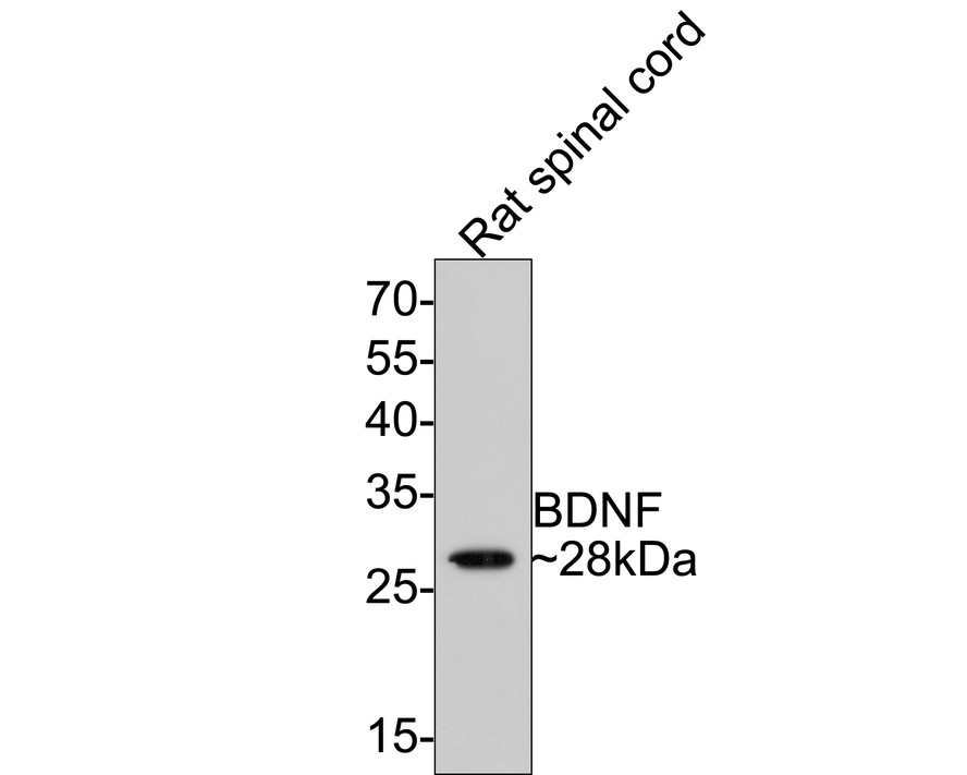 Western blot analysis of BDNF on rat spinal cord tissue lysates with Rabbit anti-BDNF antibody (ER130915) at 1/500 dilution.<br />
<br />
Lysates/proteins at 20 µg/Lane.<br />
<br />
Predicted band size: 28 kDa<br />
Observed band size: 28 kDa<br />
<br />
Exposure time: 2 minutes;<br />
<br />
12% SDS-PAGE gel.<br />
<br />
Proteins were transferred to a PVDF membrane and blocked with 5% NFDM/TBST for 1 hour at room temperature. The primary antibody (ER130915) at 1/500 dilution was used in 5% NFDM/TBST at room temperature for 2 hours. Goat Anti-Rabbit IgG - HRP Secondary Antibody (HA1001) at 1:300,000 dilution was used for 1 hour at room temperature.