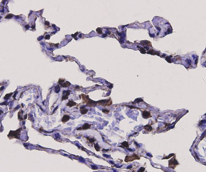 Immunohistochemical analysis of paraffin-embedded mouse lung tissue with Rabbit anti-BDNF antibody (ER130915) at 1/50 dilution.<br />
<br />
The section was pre-treated using heat mediated antigen retrieval with Tris-EDTA buffer (pH 9.0) for 20 minutes. The tissues were blocked in 1% BSA for 20 minutes at room temperature, washed with ddH2O and PBS, and then probed with the primary antibody (ER130915) at 1/50 dilution for 1 hour at room temperature. The detection was performed using an HRP conjugated compact polymer system. DAB was used as the chromogen. Tissues were counterstained with hematoxylin and mounted with DPX.