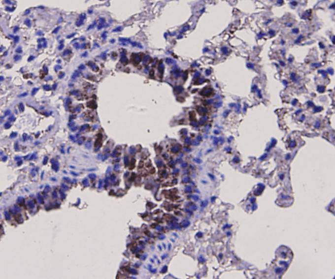 Immunohistochemical analysis of paraffin-embedded mouse lung tissue with Rabbit anti-BDNF antibody (ER130915) at 1/50 dilution.<br />
<br />
The section was pre-treated using heat mediated antigen retrieval with Tris-EDTA buffer (pH 9.0) for 20 minutes. The tissues were blocked in 1% BSA for 20 minutes at room temperature, washed with ddH2O and PBS, and then probed with the primary antibody (ER130915) at 1/50 dilution for 1 hour at room temperature. The detection was performed using an HRP conjugated compact polymer system. DAB was used as the chromogen. Tissues were counterstained with hematoxylin and mounted with DPX.