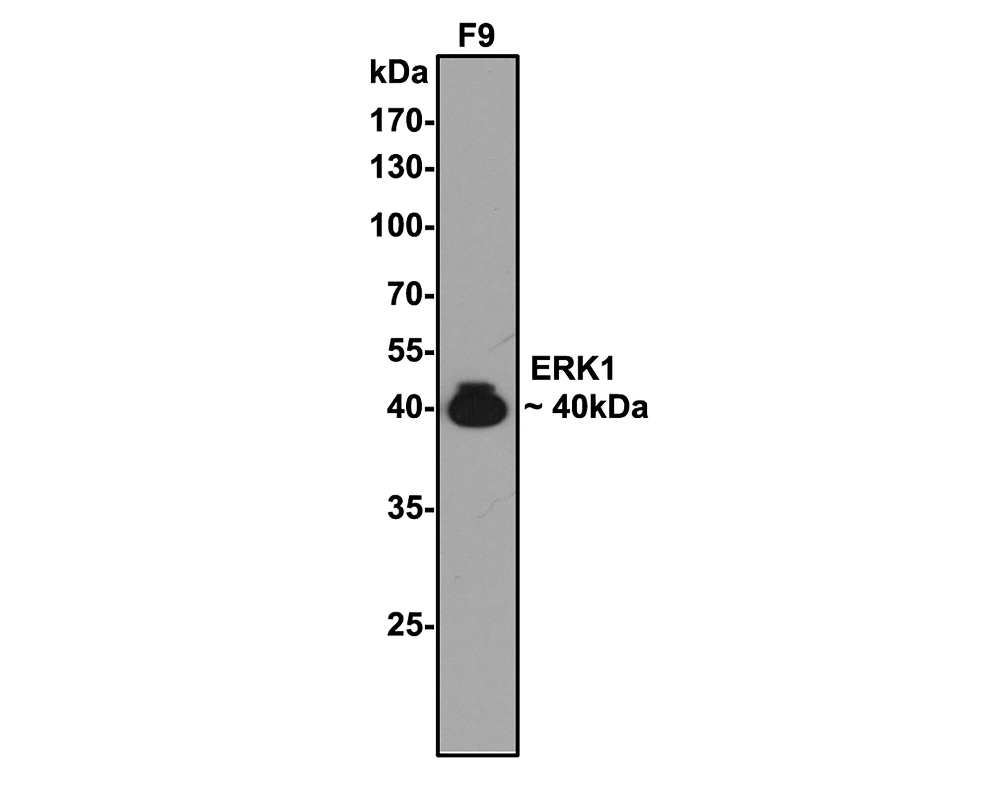 Western blot analysis of ERK1 on F9 cell lysates with Rabbit anti-ERK1 antibody (ER131011) at 1/5,000 dilution.<br />
<br />
Lysates/proteins at 10 µg/Lane.<br />
<br />
Predicted band size: 43 kDa<br />
Observed band size: 40 kDa<br />
<br />
Exposure time: 2 minutes;<br />
<br />
10% SDS-PAGE gel.<br />
<br />
Proteins were transferred to a PVDF membrane and blocked with 5% NFDM/TBST for 1 hour at room temperature. The primary antibody (ER131011) at 1/5,000 dilution was used in 5% NFDM/TBST at room temperature for 2 hours. Goat Anti-Rabbit IgG - HRP Secondary Antibody (HA1001) at 1:300,000 dilution was used for 1 hour at room temperature.