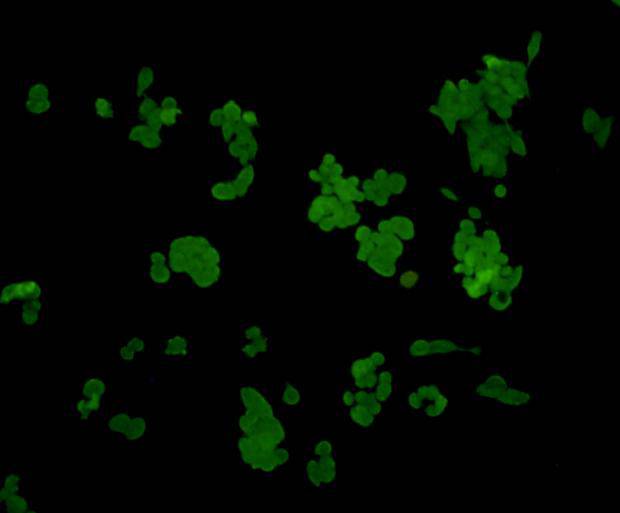 ICC staining of ERK1 in LOVO cells (green). Cells were fixed in paraformaldehyde, permeabilised with 0.25% Triton X100/PBS.