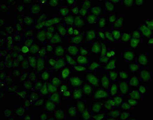 ICC staining of ICAM1 in HUVEC cells (green). Cells were fixed in paraformaldehyde, permeabilised with 0.25% Triton X100/PBS.