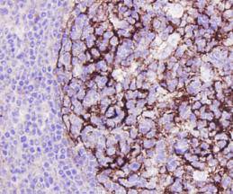 Immunohistochemical analysis of paraffin-embedded human tonsil tissue using anti-ICAM1 antibody. Counter stained with hematoxylin.