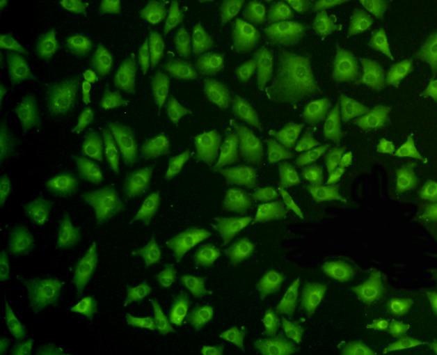ICC staining ERK2 in A549 cells (green). Formalin fixed cells were permeabilized with 0.1% Triton X-100 in TBS for 10 minutes at room temperature and blocked with 1% Blocker BSA for 15 minutes at room temperature. Cells were probed with the antibody (ER131218) at a dilution of 1:100 for 1 hour at room temperature, washed with PBS. Alexa Fluorc™ 488 Goat anti-Rabbit IgG was used as the secondary antibody at 1/100 dilution.