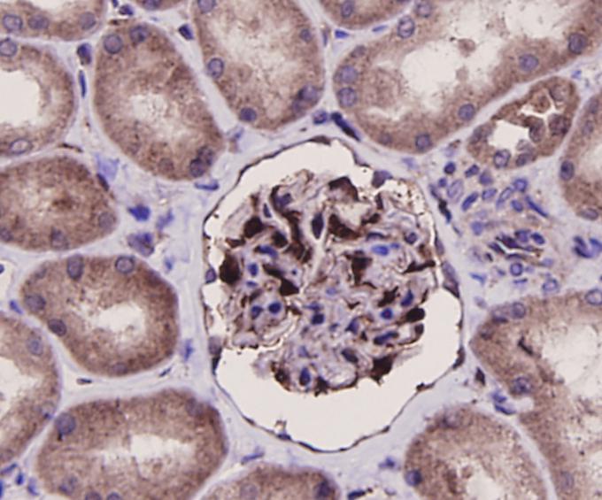Immunohistochemical analysis of paraffin-embedded human kidney tissue using anti-ERK2 antibody. The section was pre-treated using heat mediated antigen retrieval with Tris-EDTA buffer (pH 8.0-8.4) for 20 minutes.The tissues were blocked in 5% BSA for 30 minutes at room temperature, washed with ddH2O and PBS, and then probed with the antibody (ER131218) at 1/100 dilution, for 30 minutes at room temperature and detected using an HRP conjugated compact polymer system. DAB was used as the chrogen. Counter stained with hematoxylin and mounted with DPX.