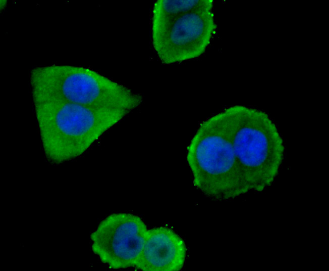 ICC staining Glut1 in Hela cells (green). The nuclear counter stain is DAPI (blue). Cells were fixed in paraformaldehyde, permeabilised with 0.25% Triton X100/PBS.