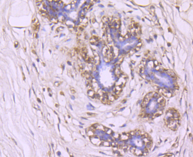 Immunohistochemical analysis of paraffin-embedded human breast tissue using anti-Glut1 antibody. Counter stained with hematoxylin.