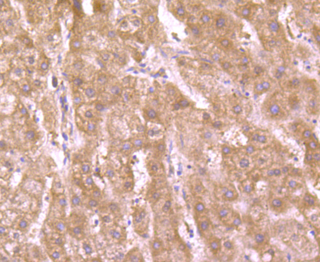 Immunohistochemical analysis of paraffin-embedded human liver tissue using anti-Glut1 antibody. Counter stained with hematoxylin.