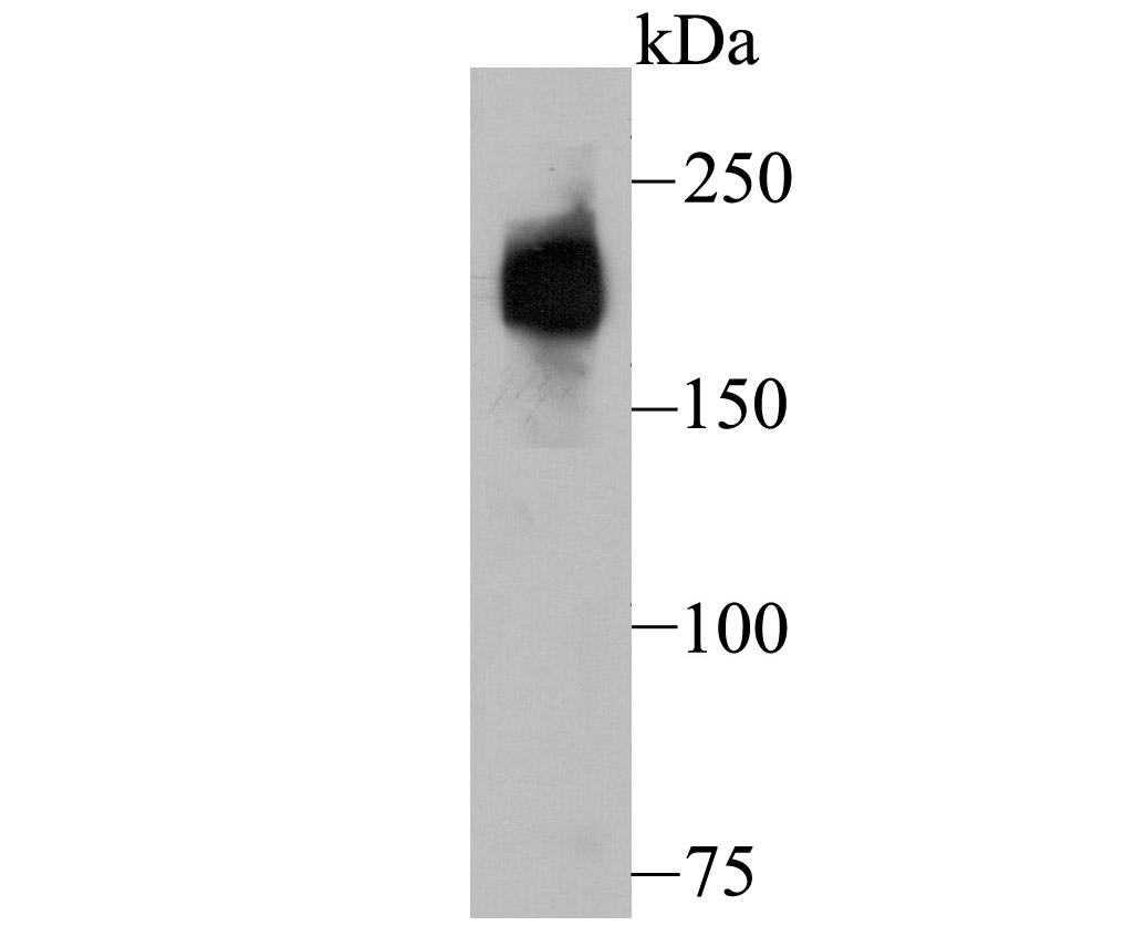 Western blot analysis of Dysferlin on human fetal skeletal muscle tissue lysate using anti-Dysferlin antibody at 1/500 dilution.