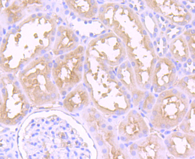 Immunohistochemical analysis of paraffin-embedded human kidney tissue using anti-Dysferlin antibody. Counter stained with hematoxylin.