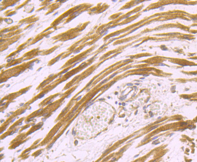 Immunohistochemical analysis of paraffin-embedded human fetal skeletal muscle tissue using anti-Dysferlin antibody. Counter stained with hematoxylin.