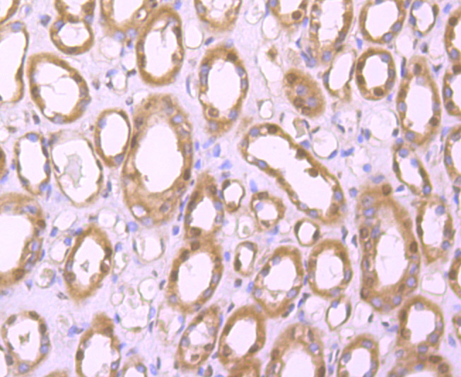 Immunohistochemical analysis of paraffin-embedded human kidney tissue using anti-PHF10 antibody. Counter stained with hematoxylin.