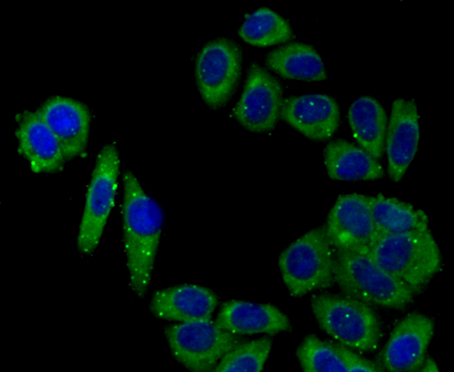 ICC staining NOX2/gp91phox in HepG2 cells (green). The nuclear counter stain is DAPI (blue). Cells were fixed in paraformaldehyde, permeabilised with 0.25% Triton X100/PBS.