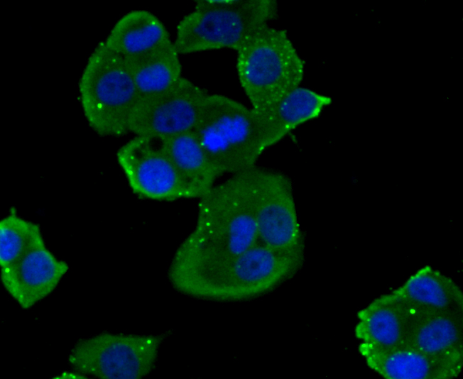 ICC staining NOX2/gp91phox in MCF-7 cells (green). The nuclear counter stain is DAPI (blue). Cells were fixed in paraformaldehyde, permeabilised with 0.25% Triton X100/PBS.