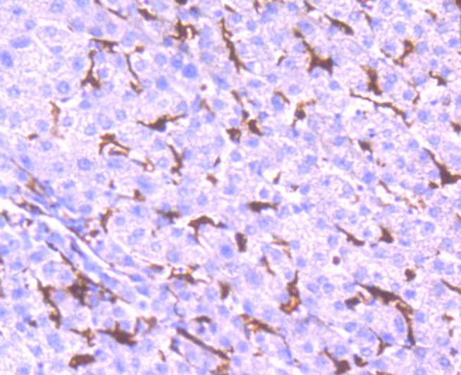 Immunohistochemical analysis of paraffin-embedded human liver tissue using anti-NOX2/gp91phox antibody. Counter stained with hematoxylin.